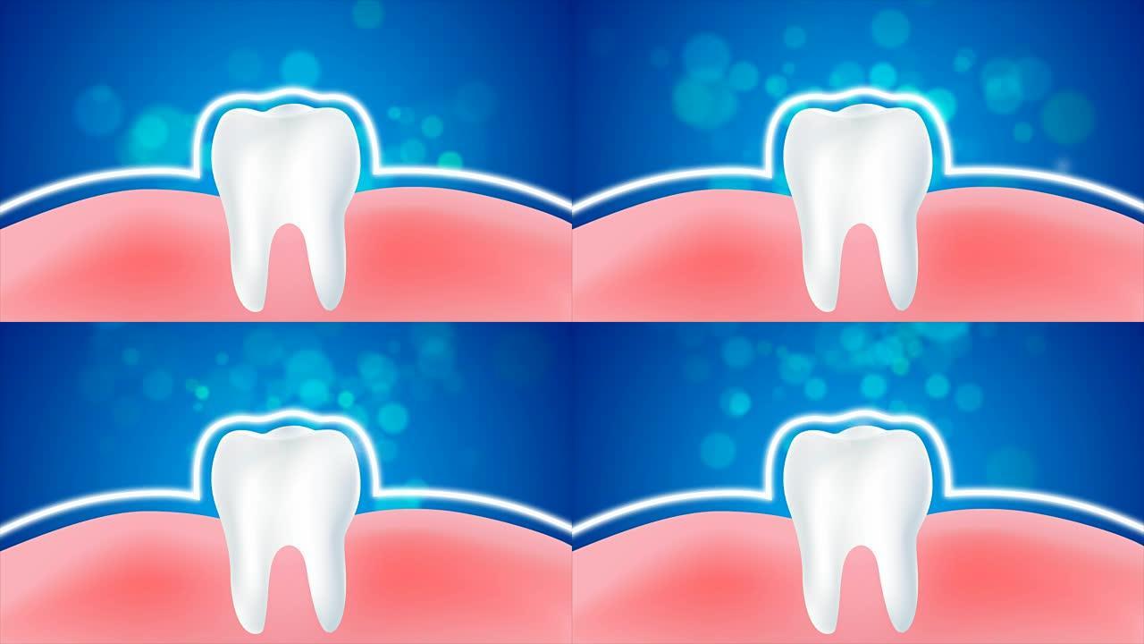 4k动画清洁和肮脏的牙齿和牙龈，美白和保护健康的口腔概念