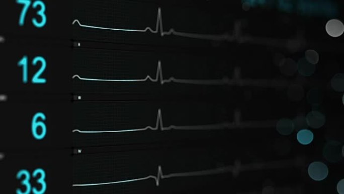 医疗监护仪显示带dop的ECG无缝循环动画