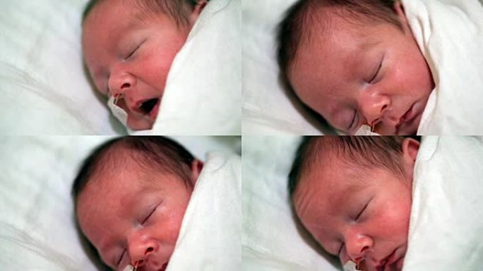 用鼻饲管睡觉的早产男孩-特写 (视频)。