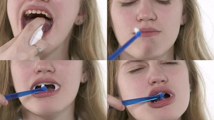 牙套的口腔卫生。戴着牙套的年轻女孩清洁牙齿