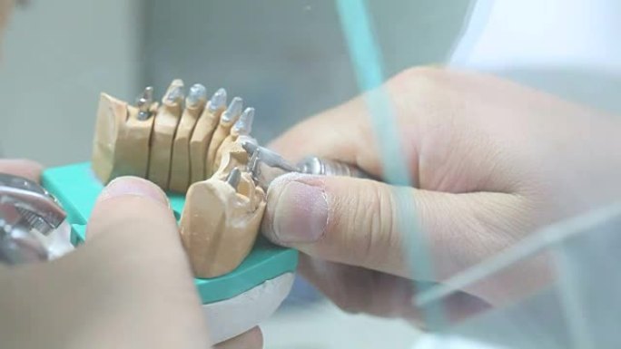牙科诊所，牙科手生产新的牙齿用于种植特写