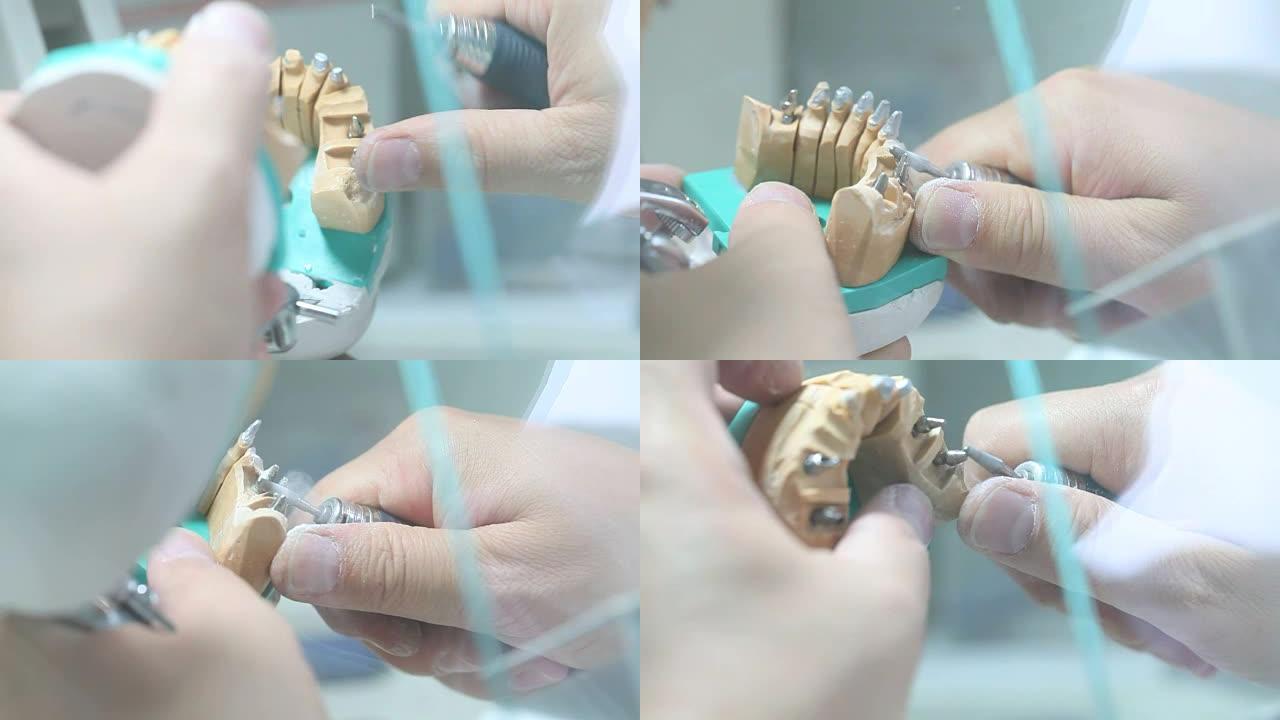 牙科诊所，牙科手生产新的牙齿用于种植特写