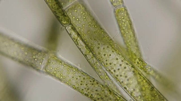 显微镜下的绿藻