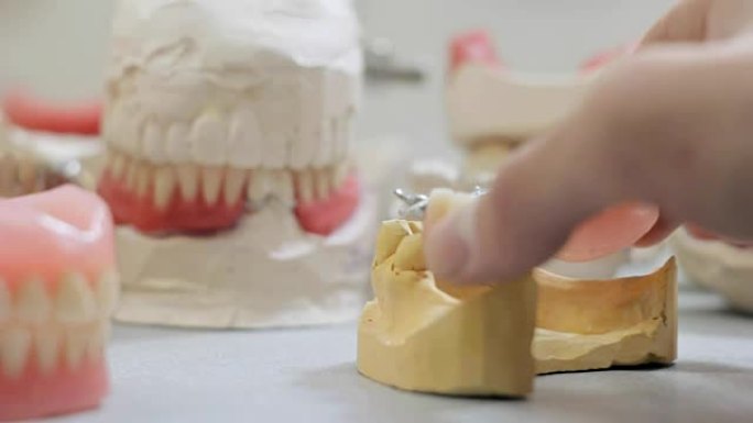 医生在牙科实验室的颌骨模型上戴假牙
