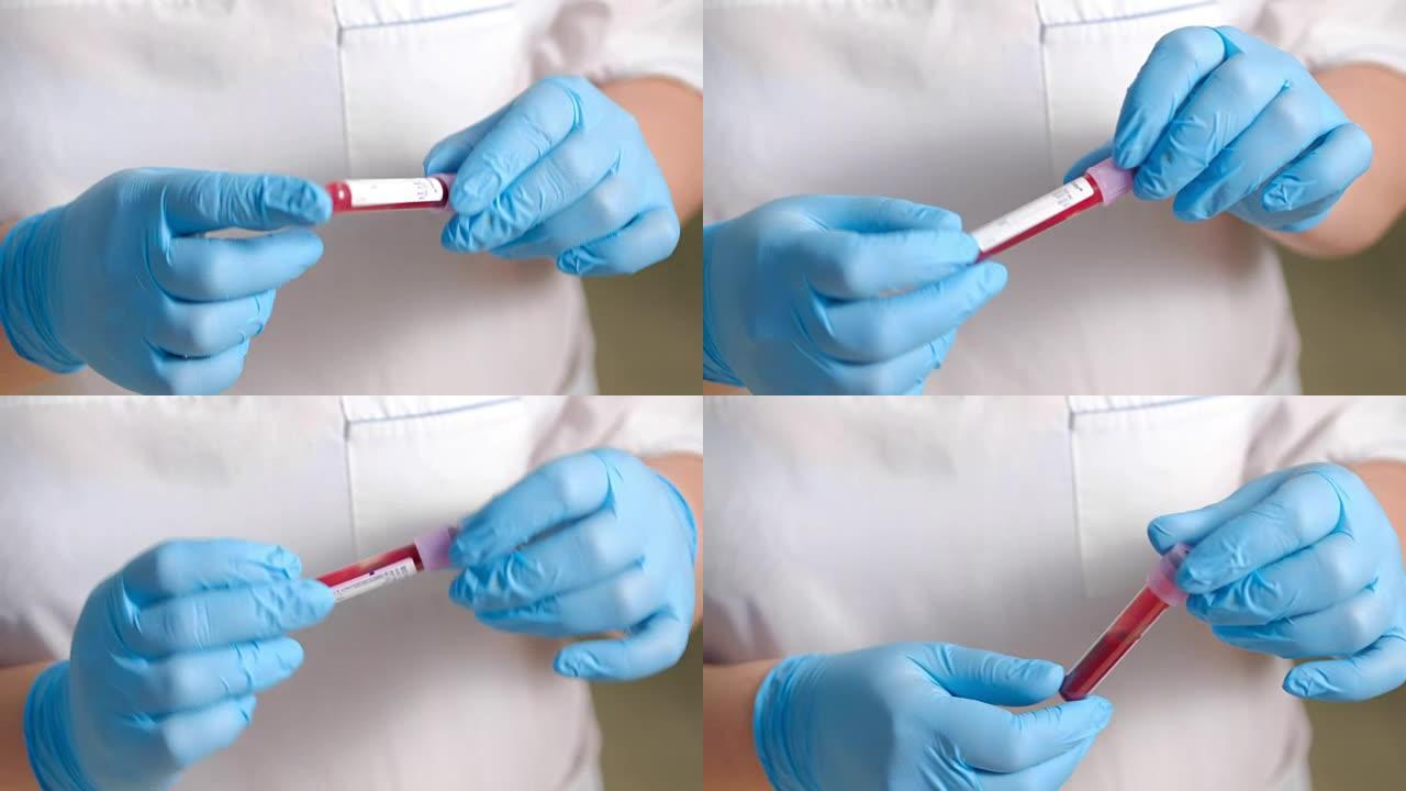 女实验室技术人员戴着防护手套，拿着移液器，在医院病房中测试血液样本是否输血，双手合十。试管。血液采样