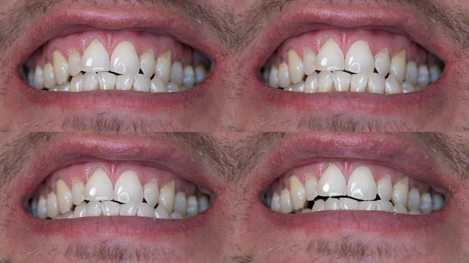一个男人露出牙齿，张开手指的嘴唇，特写