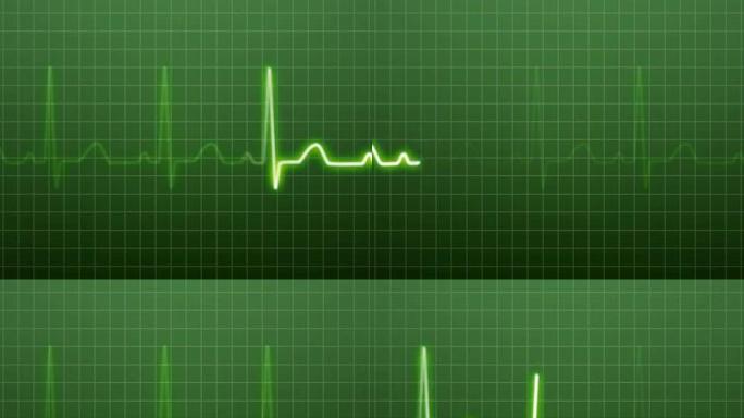 EKG/脉冲波形绿色