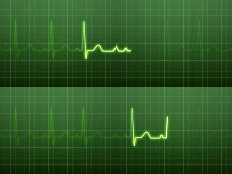 EKG/脉冲波形绿色