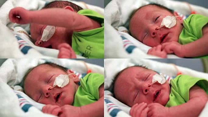 用鼻饲管睡觉的早产男孩 (视频)。