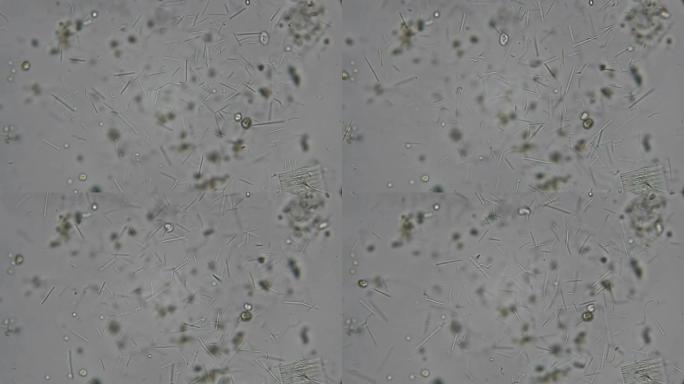 显微镜下有杆状细菌和螺旋藻的肮脏水滴