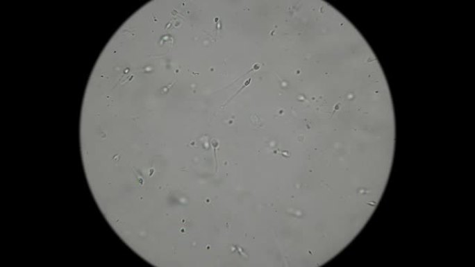 显微镜下精子的运动