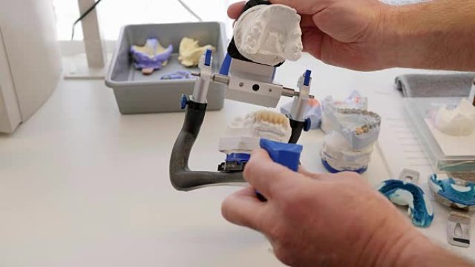 牙科植入物的生产，技术人员在室内特殊支架的颌骨模型上显示陶瓷牙齿