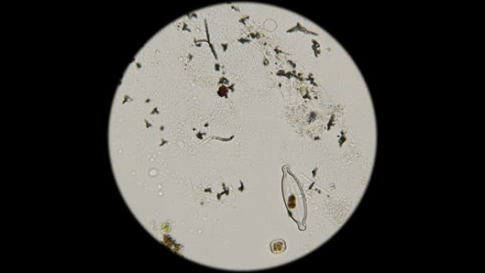 螺旋，弯曲细菌，寄生虫，显微镜下