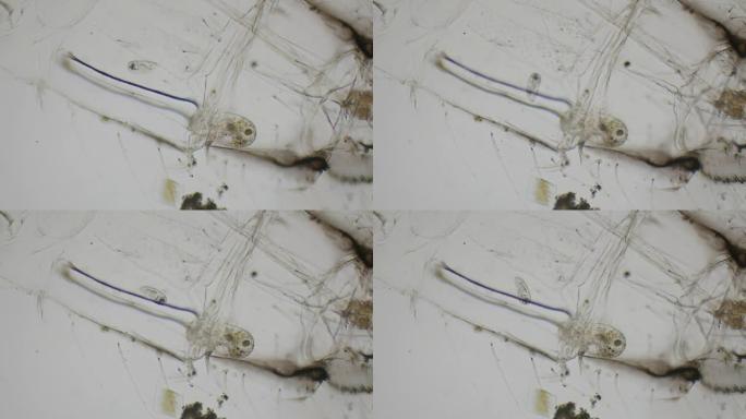 4k显微镜下纤毛虫