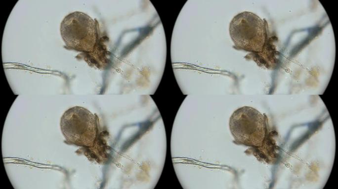 死尘螨成为微生物的栖息地，在显微镜下