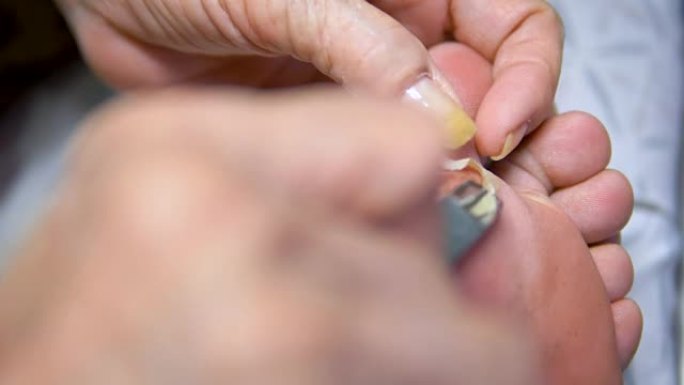 亚洲老年妇女使用指甲钳在脚上切割皮肤。