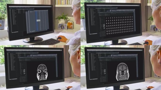 女医生坐在办公桌前检查计算机上的x射线图像