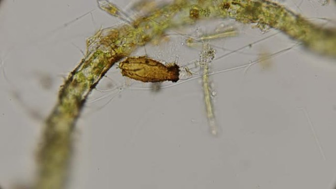 显微镜下的Peritricha物种infusoria，Pyxicola类