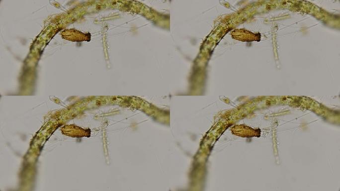 显微镜下的Peritricha物种infusoria，Pyxicola类