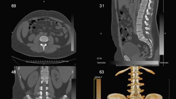 CT扫描视频幻灯片动画(NTSC, PAL)