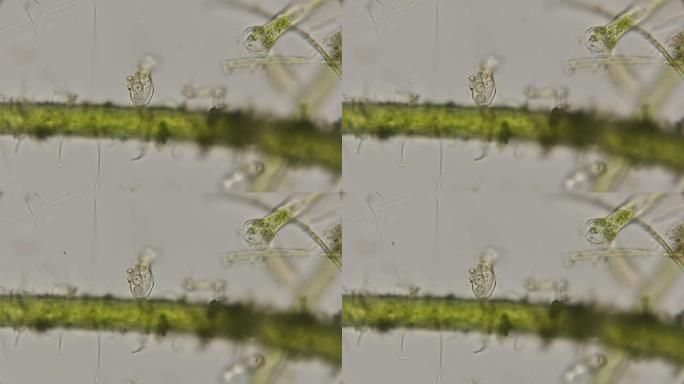 在显微镜下，水槽中的infusoria物种Peritricha得到了红斑