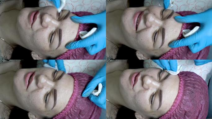 美容师在永久化妆眉毛的程序后，在美容院中治疗女孩眉毛周围的皮肤。非常特写。从顶部看。4K，25 fp