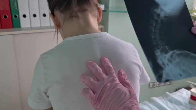儿科医生检查儿童脊柱畸形概念的x射线