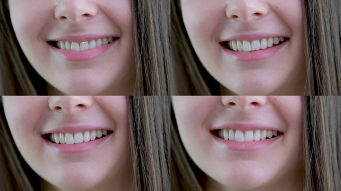 一个有着完美洁白牙齿的迷人女孩的微笑特写。完美的洁白牙齿和微笑真诚甚至洁白牙齿频率自然嘴唇空间文本自