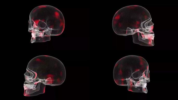 病毒3D头骨旋转在黑色背景上的传播。体内病毒的视觉演示。科学医学概念。商业背景。标题，演示。3D动画