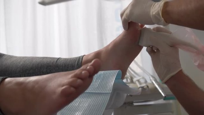 扁平足病患者的神经性关节炎，在医疗中心对患者的脚进行治疗检查，专业足病医生用激光扫描脚以建立诊断并开