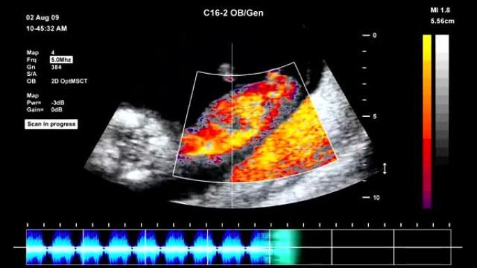 胎儿超声扫描幼声胎观儿探