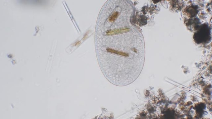 纤毛虫吃了一些硅藻