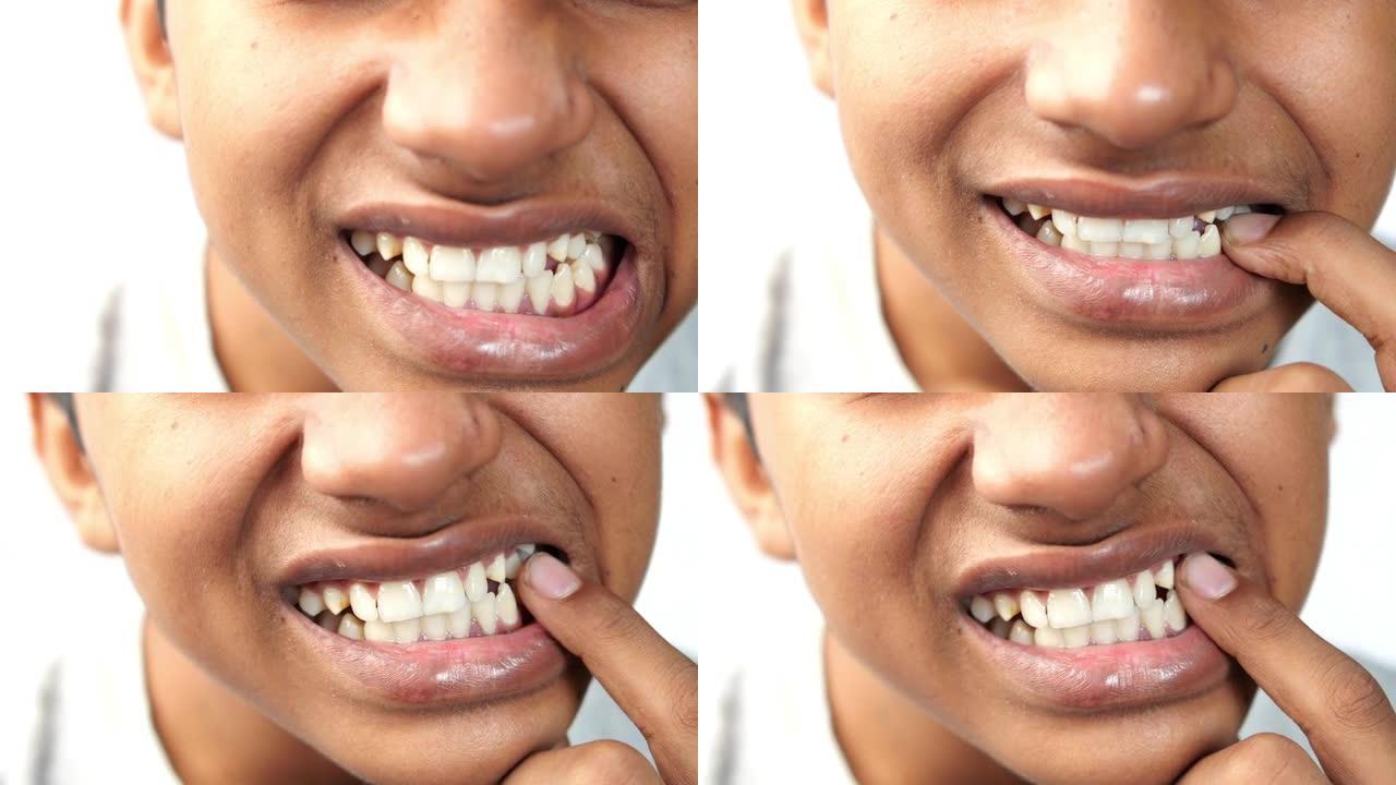 牙齿敏感的十几岁男孩