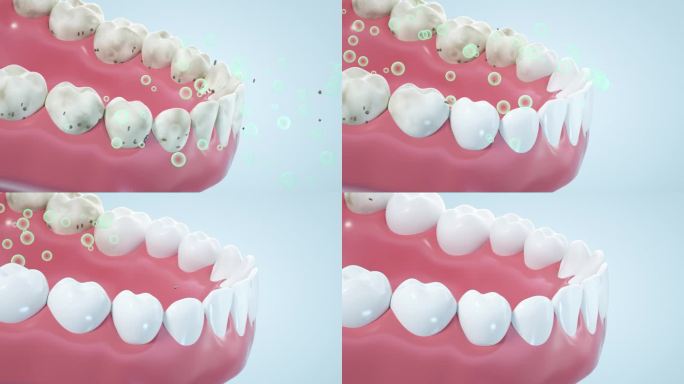 口腔牙齿去污美白C4D工程文件