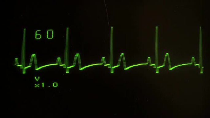EKG屏幕特写平面-高清
