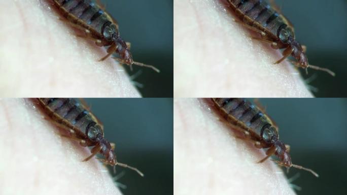 臭虫坐在人类皮肤上昆虫宏观