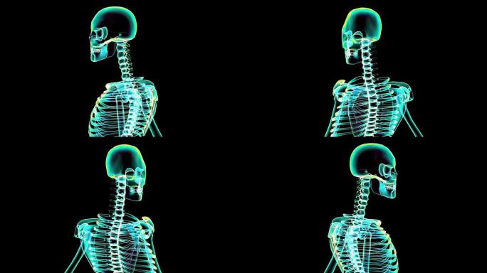 人体骨骼的x射线扫描 (HD)
