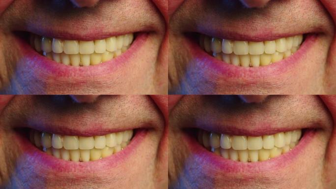 一位假牙老人的特写微笑。牙周病和老人的牙齿缺失。无牙男性嘴的特写镜头
