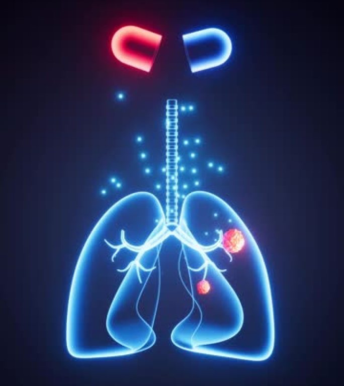 肺部疾病的药物治疗，肺部治疗，肺癌，3d渲染。