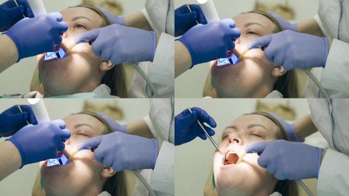 牙医治疗牙齿，补牙后用紫外线灯。