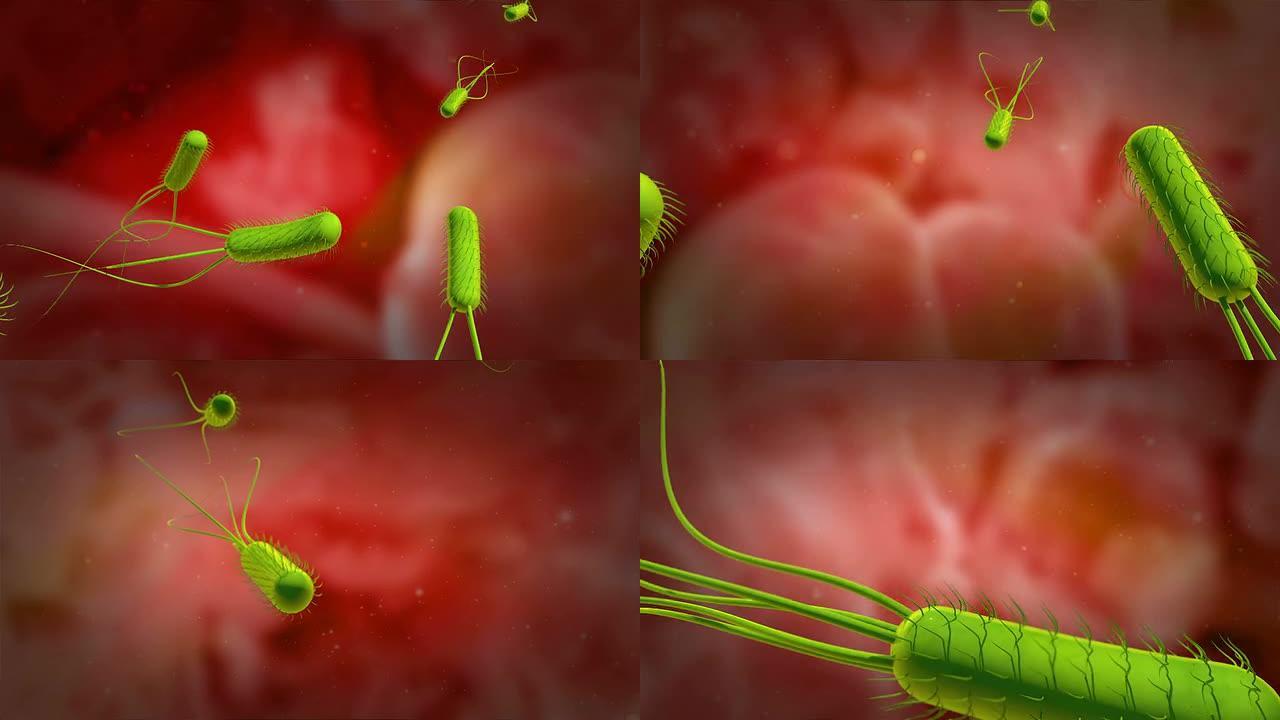 幽门螺杆菌或幽门螺杆菌的3D动画