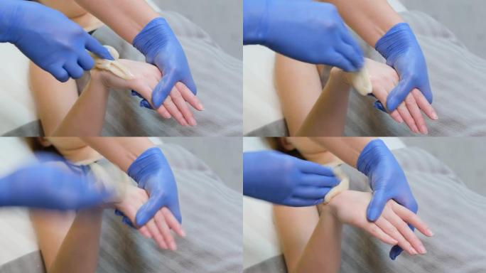 脱毛前将糖膏涂在手部皮肤上的过程。