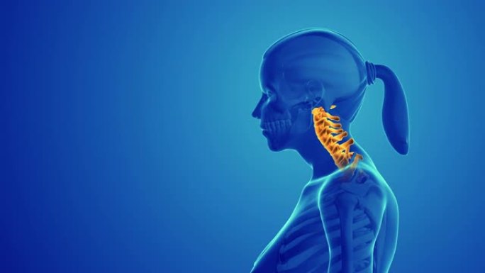 颈椎姿势综合征或颈部不适