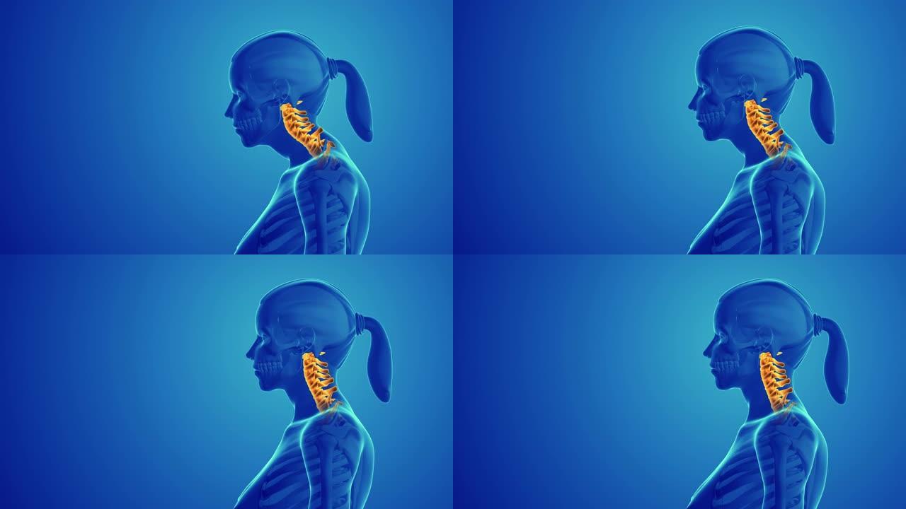 颈椎姿势综合征或颈部不适