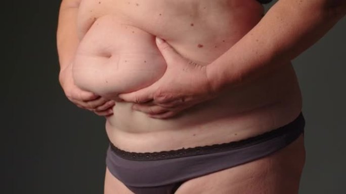 超重沉重的老年妇女捏她的腹部脂肪，暴饮暴食问题，肥胖。体重人的身体脂肪多于最佳体重，体重指数，不健康