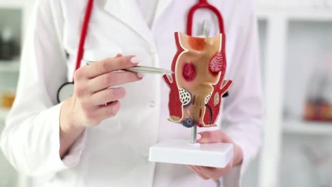 医学教授在人体器官人工模型上显示直肠疾病特写4k电影慢动作