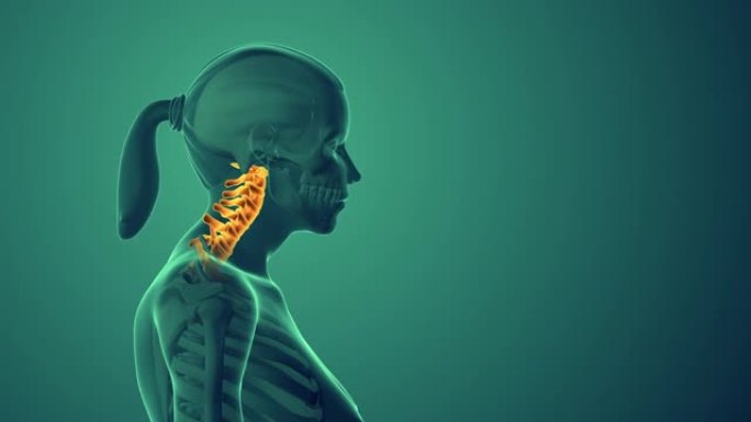 颈部不适或颈椎姿势综合征
