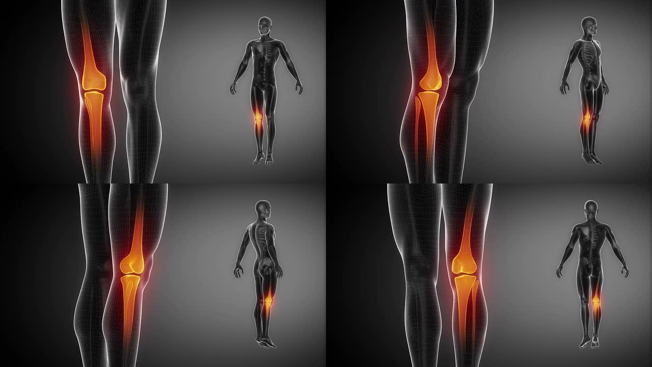黑色膝关节骨骼x射线扫描