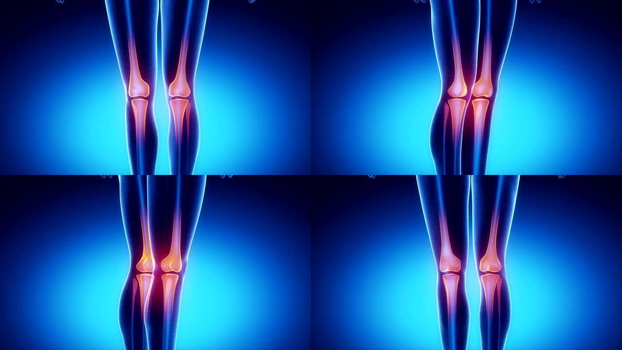 蓝色膝关节骨骼x射线扫描