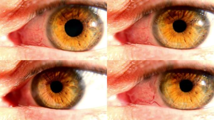 瞳孔扩张的人眼球